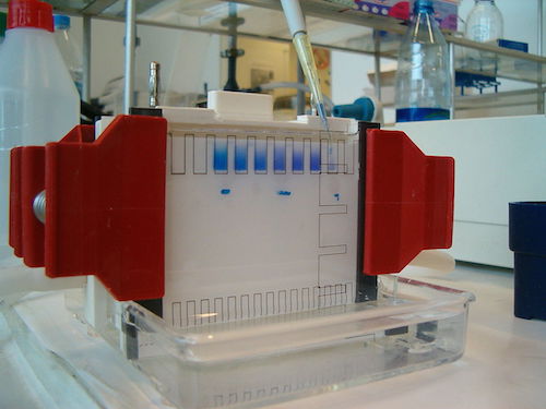 Electrophoresis