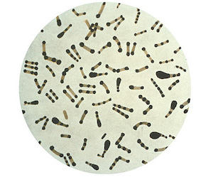 Corynebacterium diptheria
