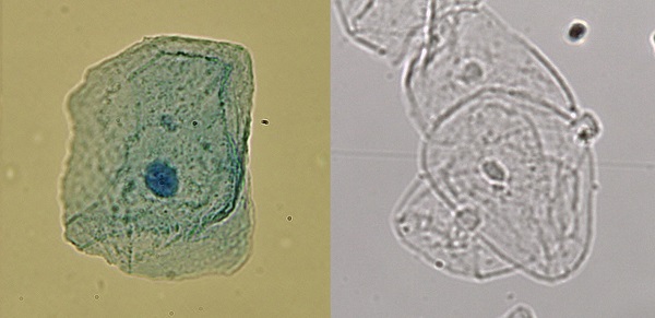 Cheek cells