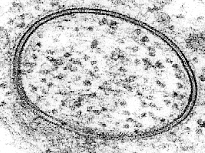 Vesicle