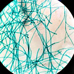 Cyanobacteria