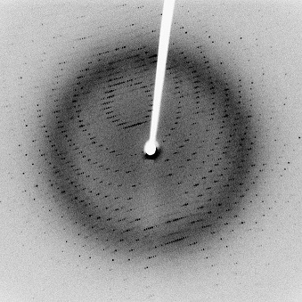 Xray diffraction