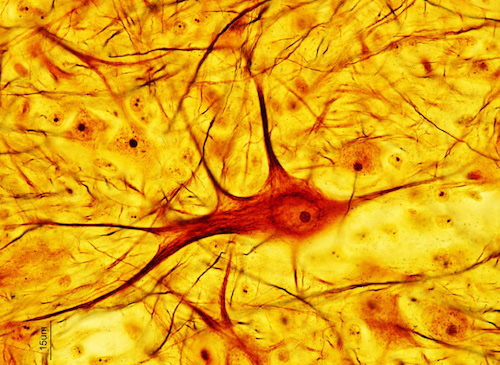 Golgi stain