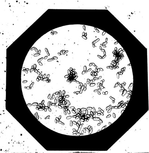 Figure 2: Yeast cells (Mycoderma vini) on the surface of wine. 
