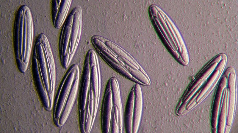 Figure 3a: Epulopiscium viviparus bacteria. Would you call this budding?